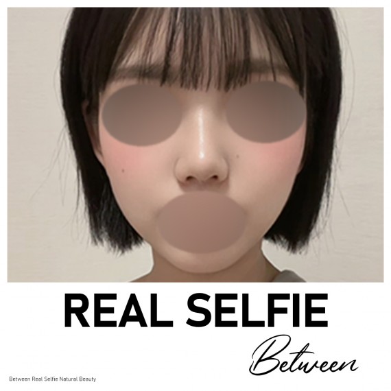 비…